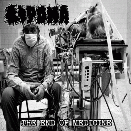 Lipoma : The End of Medicine